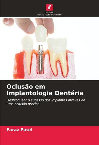 Oclusão em Implantologia Dentária