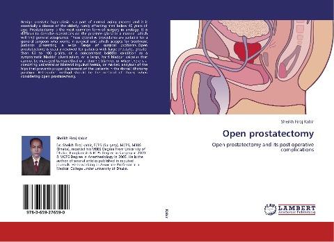 Open prostatectomy