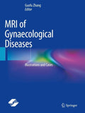 MRI of Gynaecological Diseases