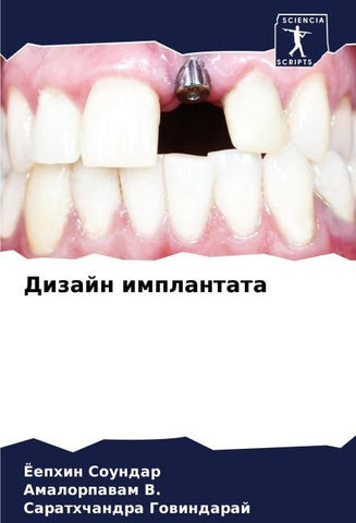 Dizajn implantata