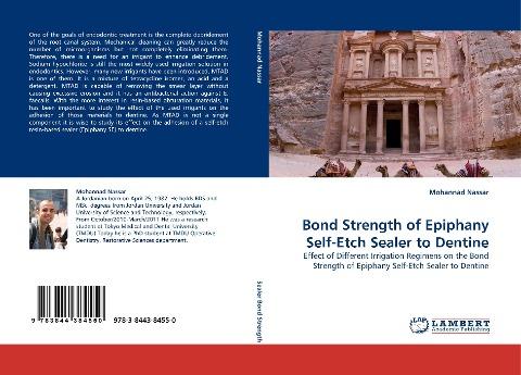 Bond Strength of Epiphany Self-Etch Sealer to Dentine