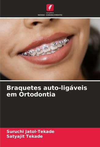 Braquetes auto-ligáveis em Ortodontia