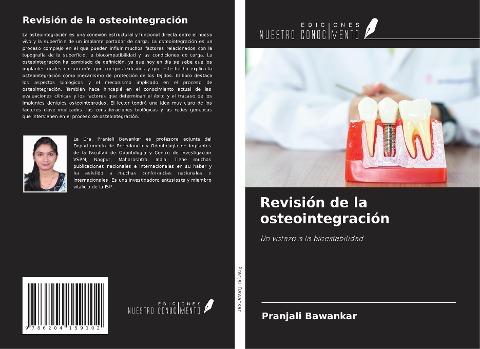 Revisión de la osteointegración