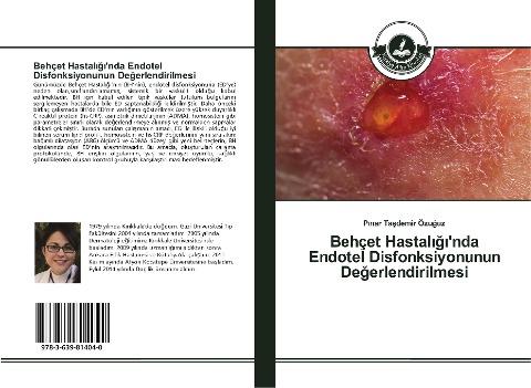Behçet Hastal¿¿¿'nda Endotel Disfonksiyonunun De¿erlendirilmesi