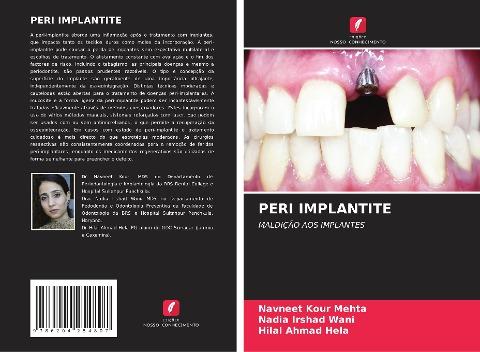 PERI IMPLANTITE