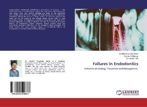 Failures in Endodontics