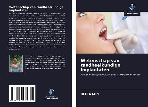 Wetenschap van tandheelkundige implantaten