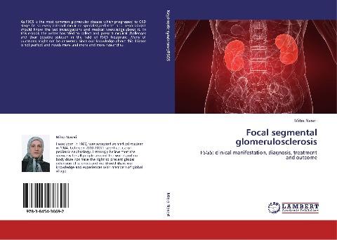 Focal segmental glomerulosclerosis