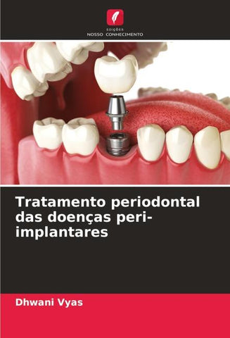 Tratamento periodontal das doenças peri-implantares
