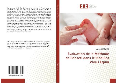 Évaluation de la Méthode de Ponseti dans le Pied Bot Varus Equin
