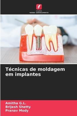Técnicas de moldagem em implantes