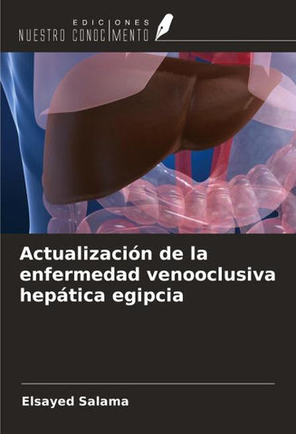 Actualización de la enfermedad venooclusiva hepática egipcia