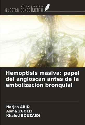 Hemoptisis masiva: papel del angioscan antes de la embolización bronquial