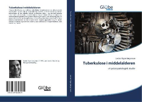 Tuberkulose i middelalderen