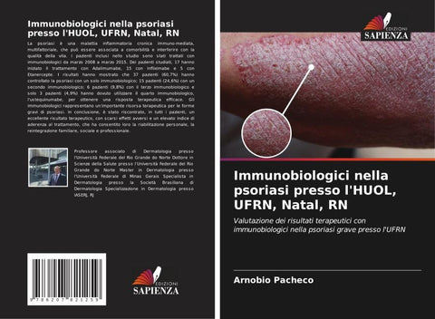 Immunobiologici nella psoriasi presso l'HUOL, UFRN, Natal, RN