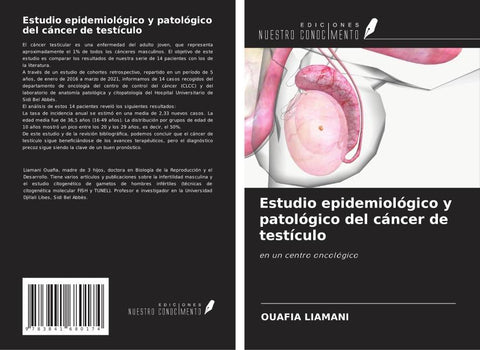 Estudio epidemiológico y patológico del cáncer de testículo