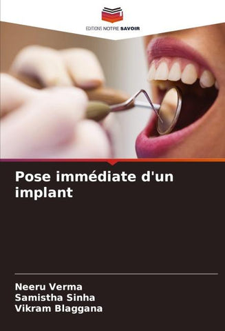 Pose immédiate d'un implant