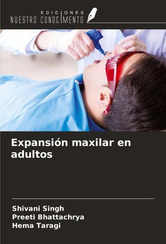 Expansión maxilar en adultos