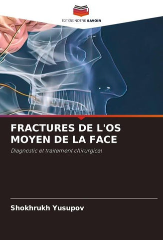 FRACTURES DE L'OS MOYEN DE LA FACE