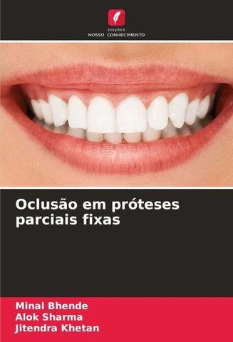 Oclusão em próteses parciais fixas