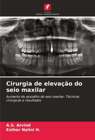 Cirurgia de elevação do seio maxilar