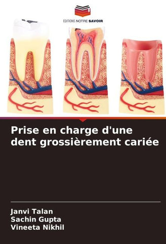 Prise en charge d'une dent grossièrement cariée