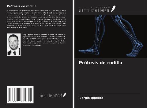 Prótesis de rodilla