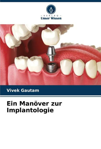 Ein Manöver zur Implantologie