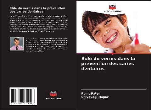 Rôle du vernis dans la prévention des caries dentaires