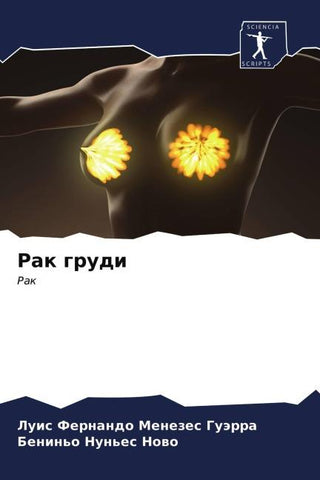 Rak grudi