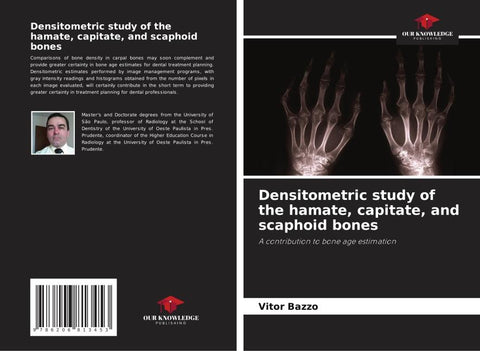 Densitometric study of the hamate, capitate, and scaphoid bones