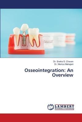 Osseointegration: An Overview