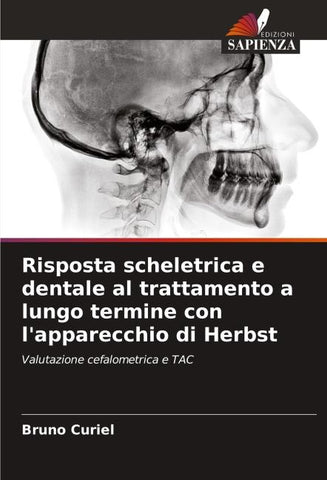 Risposta scheletrica e dentale al trattamento a lungo termine con l'apparecchio di Herbst