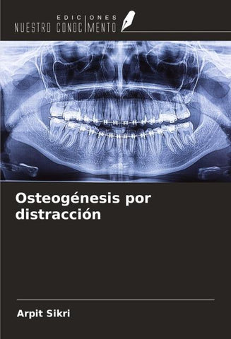 Osteogénesis por distracción