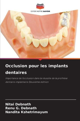 Occlusion pour les implants dentaires
