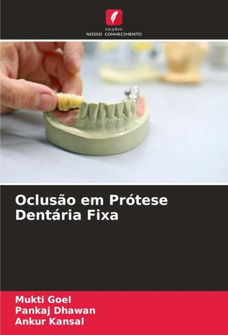 Oclusão em Prótese Dentária Fixa