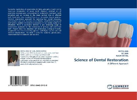 Science of Dental Restoration