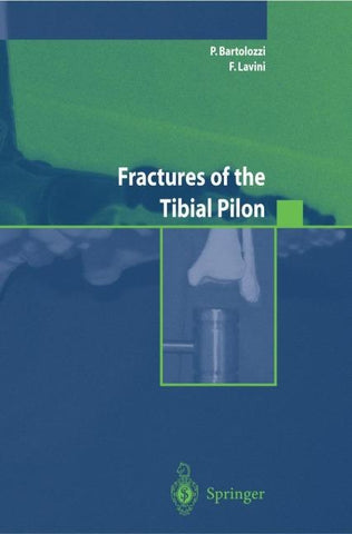 Fractures of the Tibial Pilon