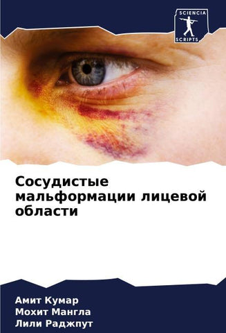 Sosudistye mal'formacii licewoj oblasti