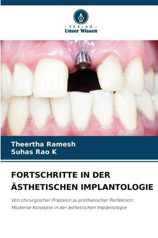 FORTSCHRITTE IN DER ÄSTHETISCHEN IMPLANTOLOGIE