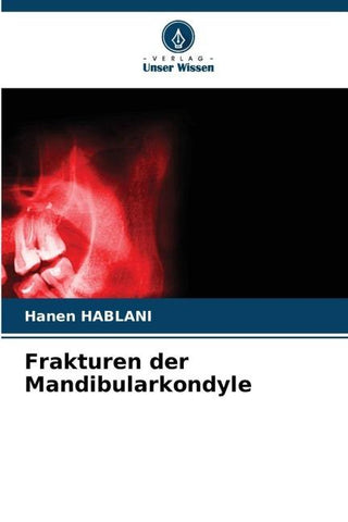 Frakturen der Mandibularkondyle