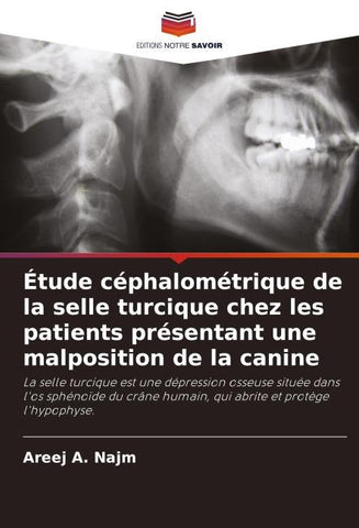Étude céphalométrique de la selle turcique chez les patients présentant une malposition de la canine
