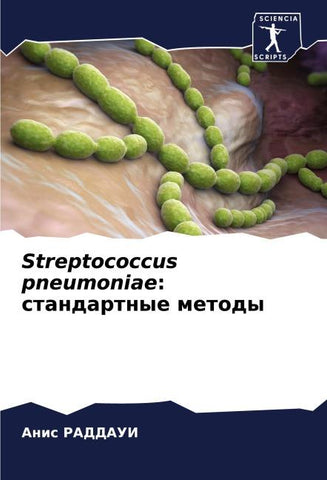 Streptococcus pneumoniae: standartnye metody