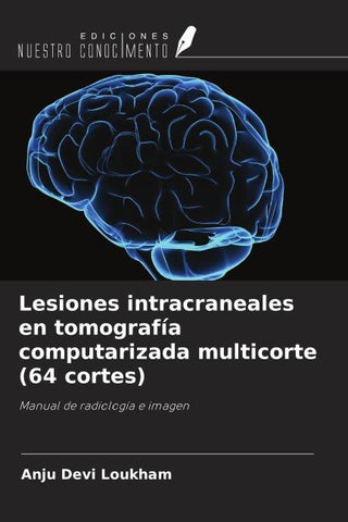 Lesiones intracraneales en tomografía computarizada multicorte (64 cortes)