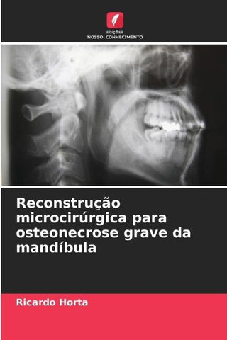 Reconstrução microcirúrgica para osteonecrose grave da mandíbula
