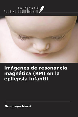 Imágenes de resonancia magnética (RM) en la epilepsia infantil