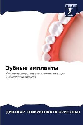 Zubnye implanty