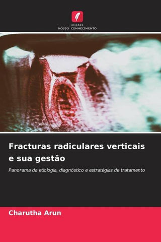 Fracturas radiculares verticais e sua gestão