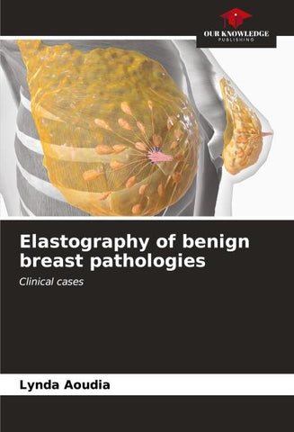 Elastography of benign breast pathologies
