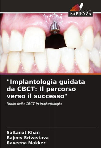 "Implantologia guidata da CBCT: Il percorso verso il successo"